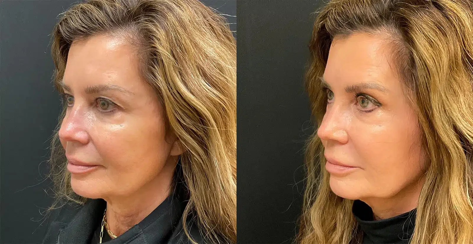 A result from My Plastic Surgery Group