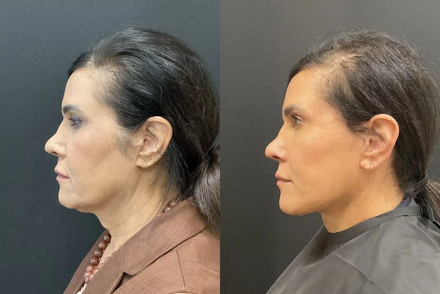 A result from My Plastic Surgery Group