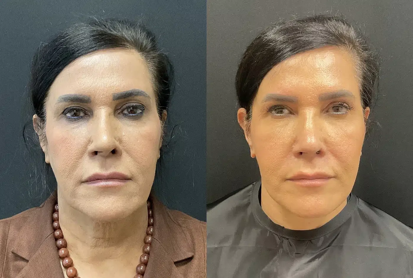 A result from My Plastic Surgery Group