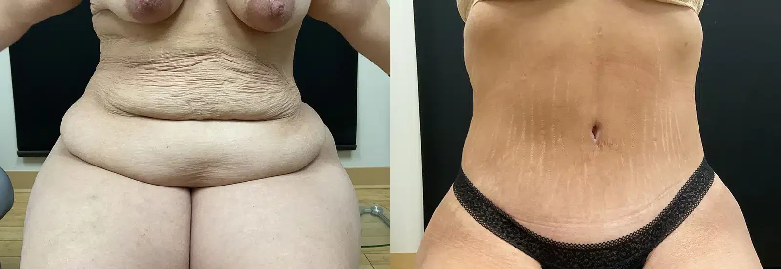 A result from My Plastic Surgery Group
