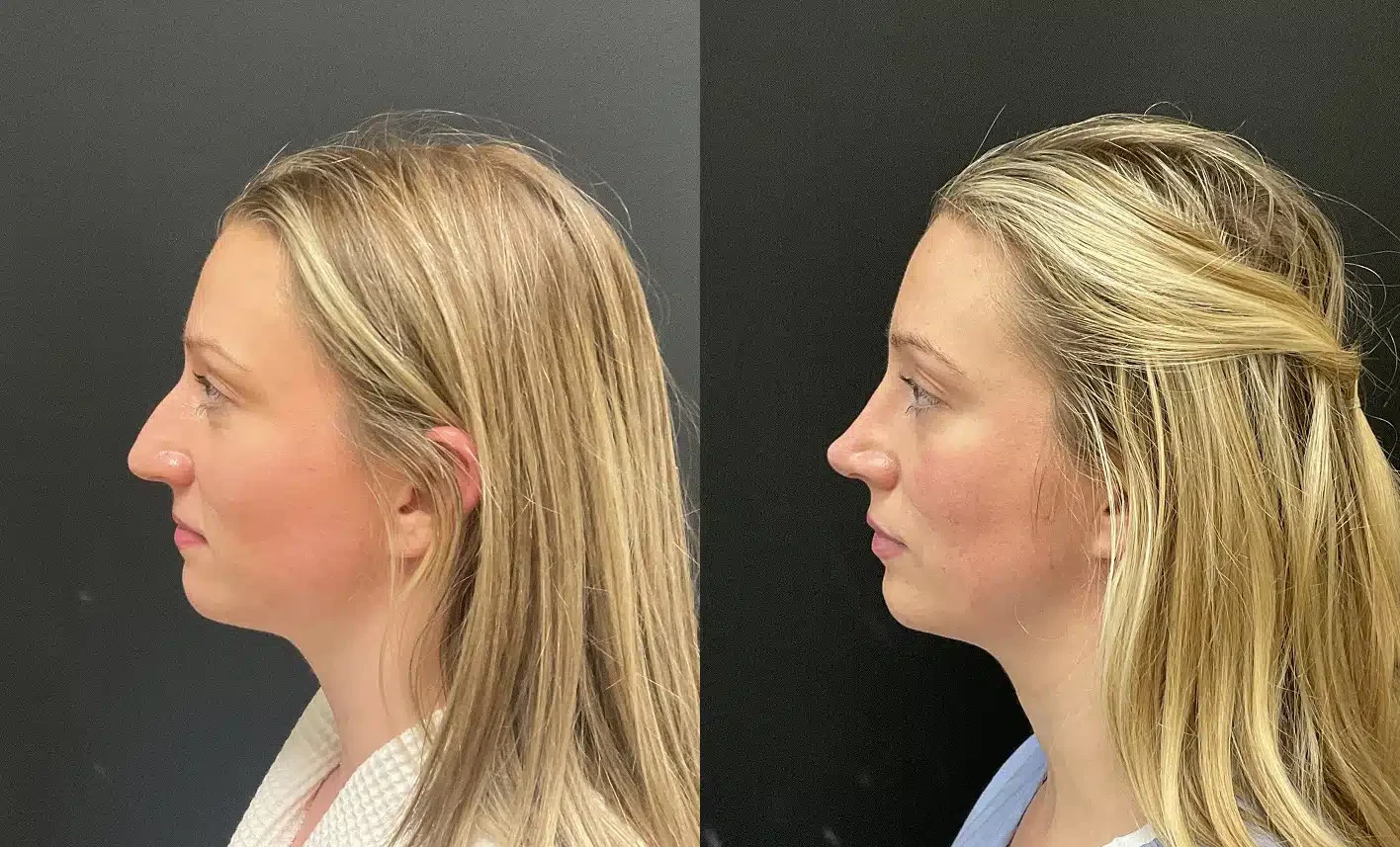 A result from My Plastic Surgery Group
