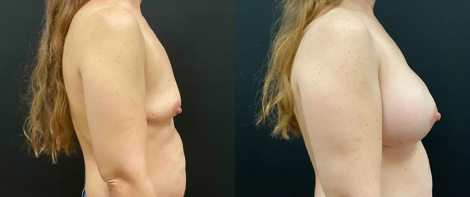 A result from My Plastic Surgery Group