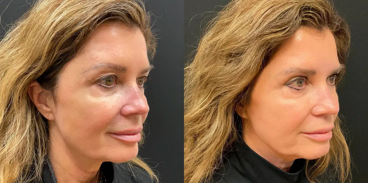 A result from My Plastic Surgery Group