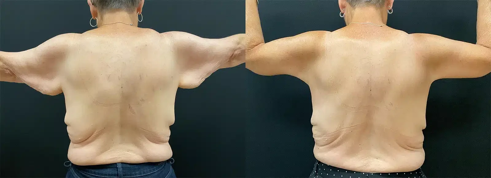 A result from My Plastic Surgery Group