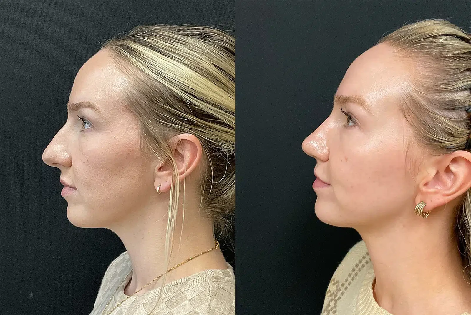 A result from My Plastic Surgery Group