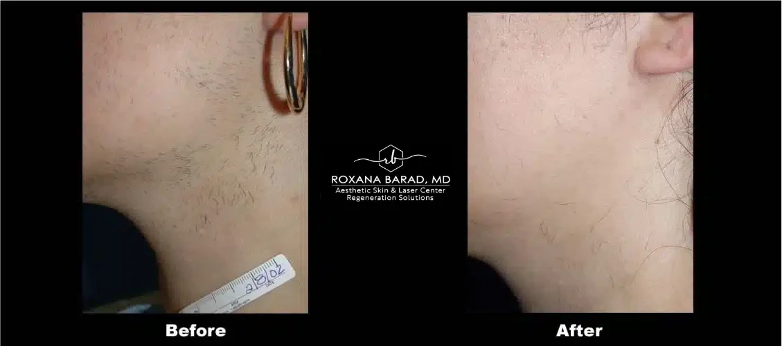 A result from Aesthetic Skin & Laser Center