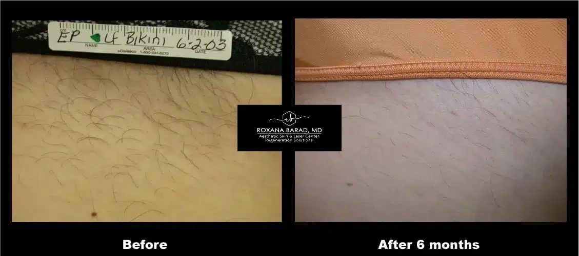 A result from Aesthetic Skin & Laser Center