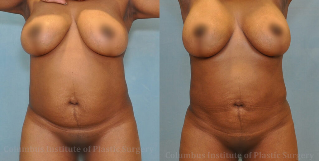 A result from Columbus Institute