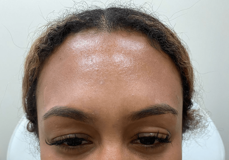 A result from ZONA MED SPA