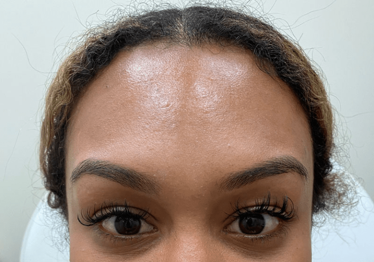 A result from ZONA MED SPA