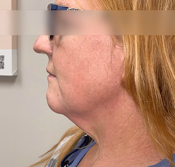 A result from ElaMar Nashville