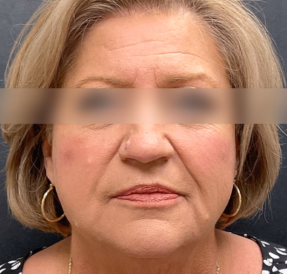 A result from ElaMar Nashville