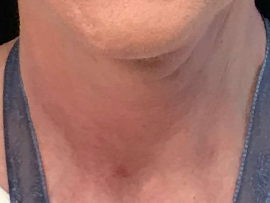 A result from SAC Plastic Surgery