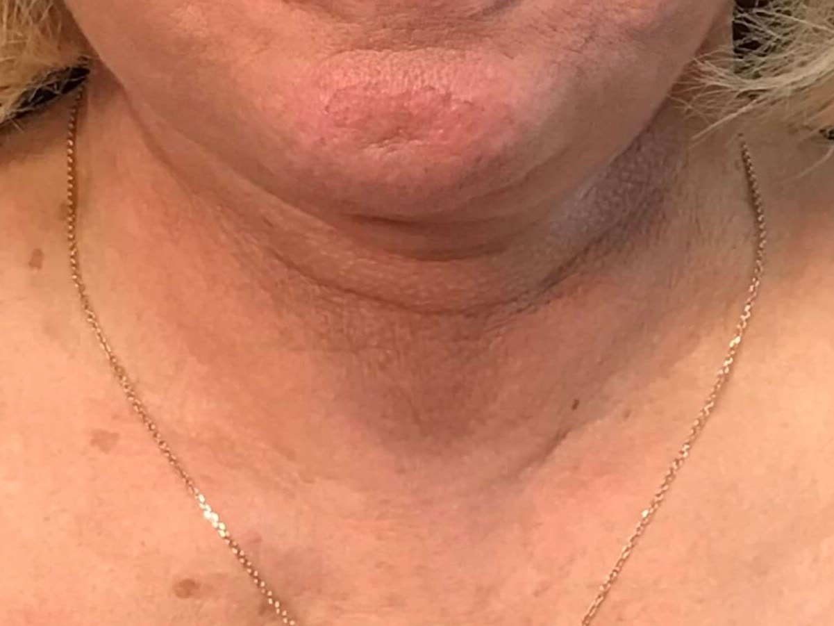 A result from SAC Plastic Surgery