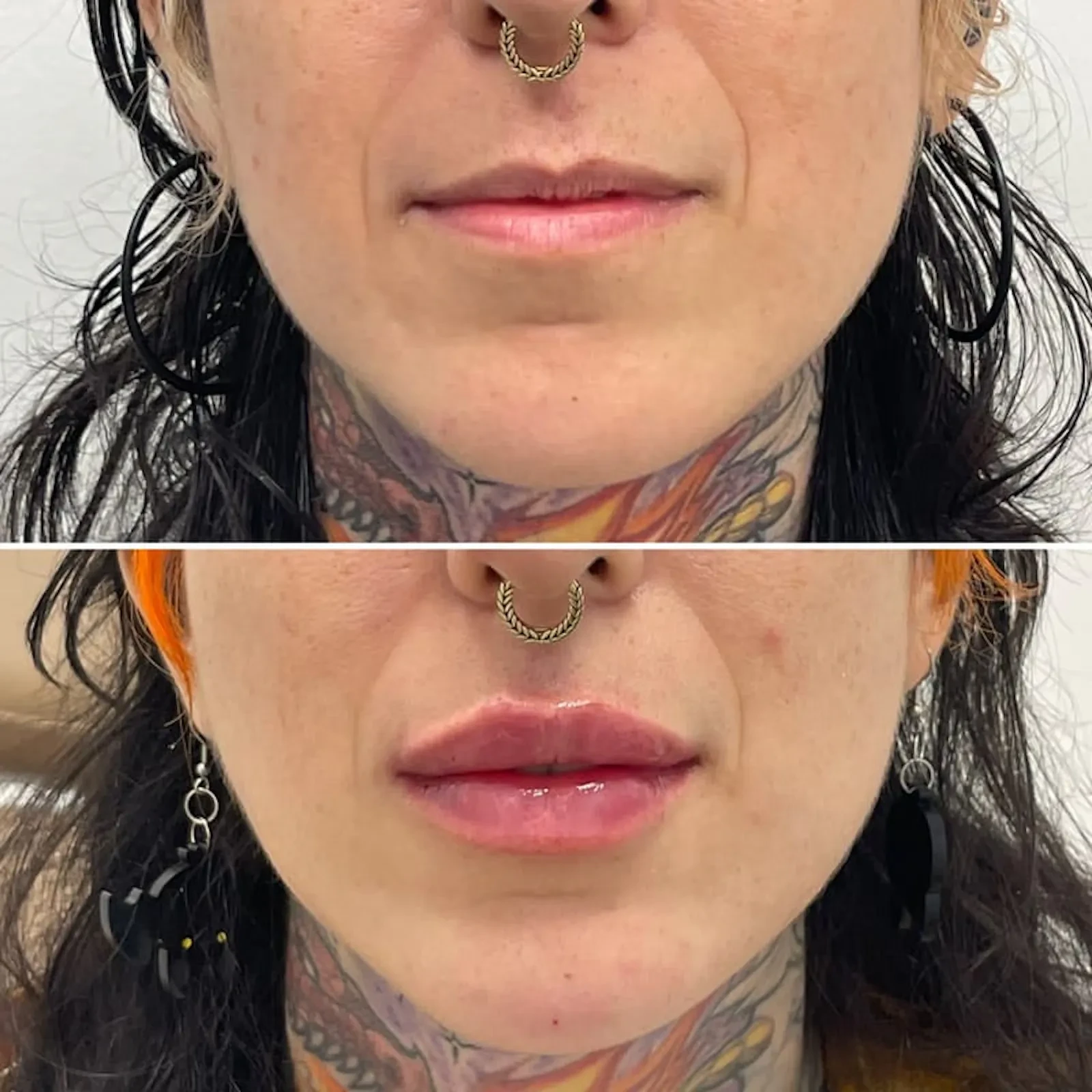 A result from Dr. Adam J. Oppenheimer, MD
