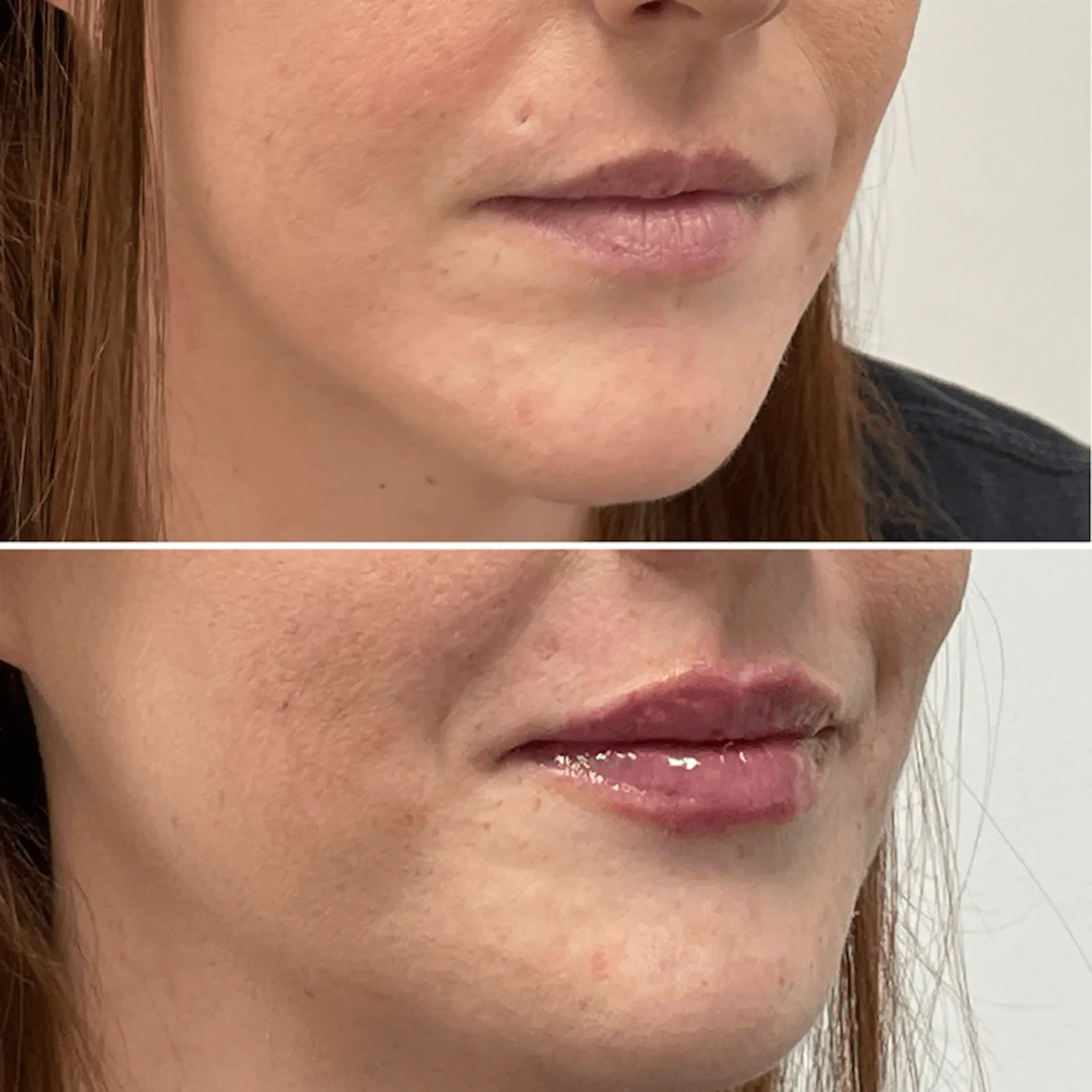 A result from Dr. Adam J. Oppenheimer, MD