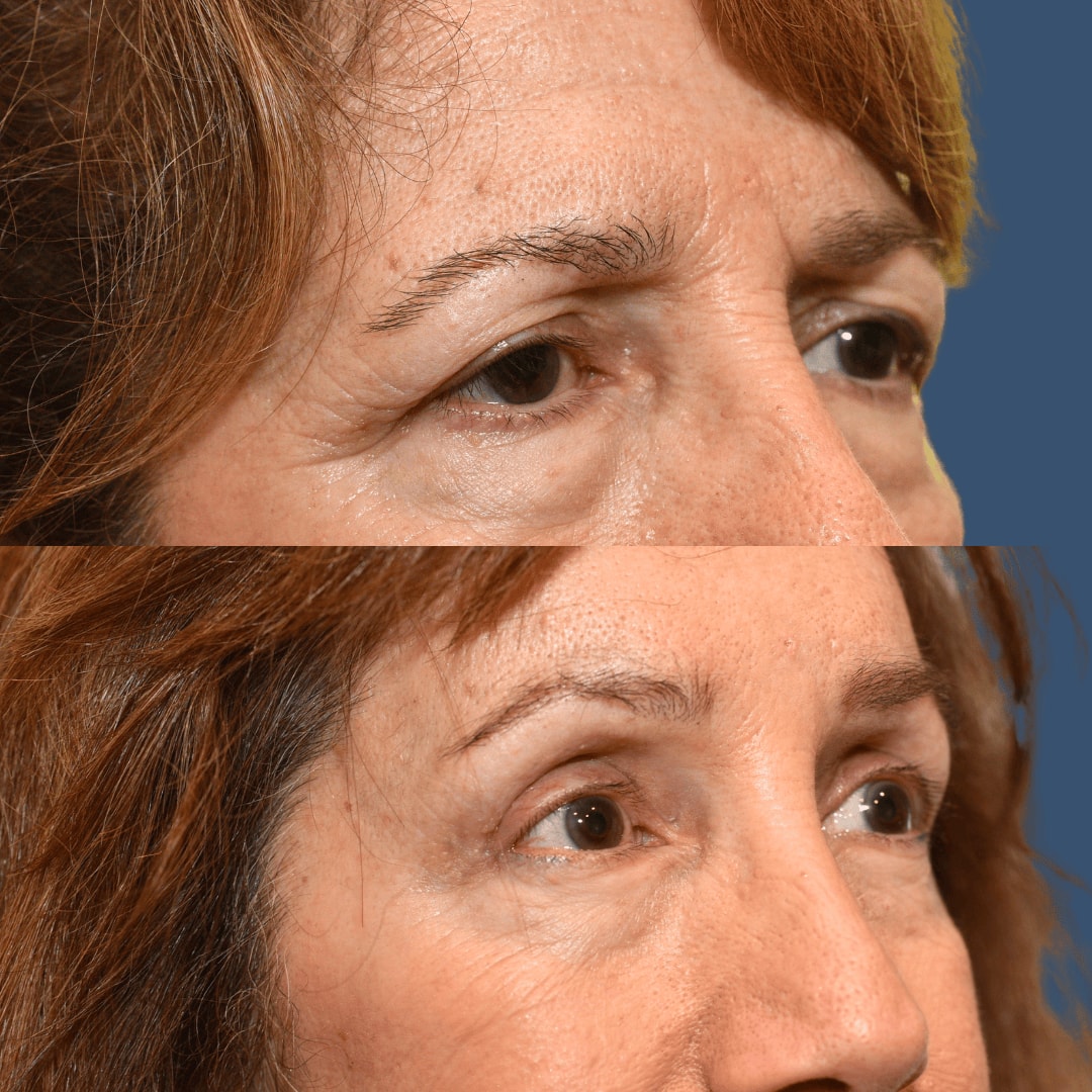 A result from Morgenstern Medical