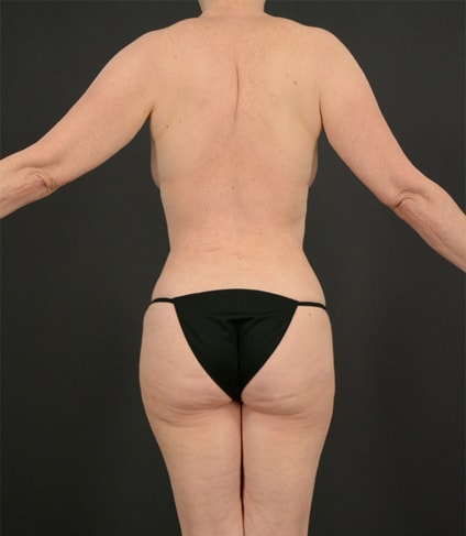 A result from DR. MICHAEL LEE