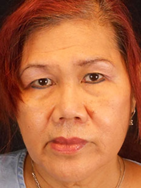 A result from Reynolds Plastic Surgery