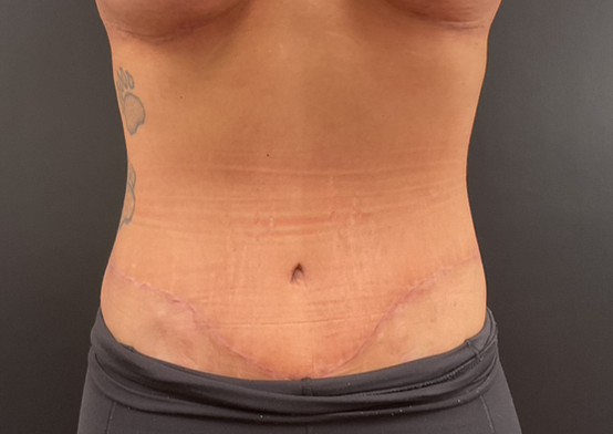 A result from Plastic Surgery Center