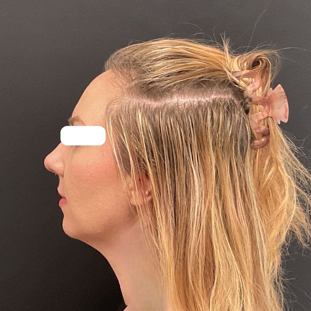 A result from Plastic Surgery Center