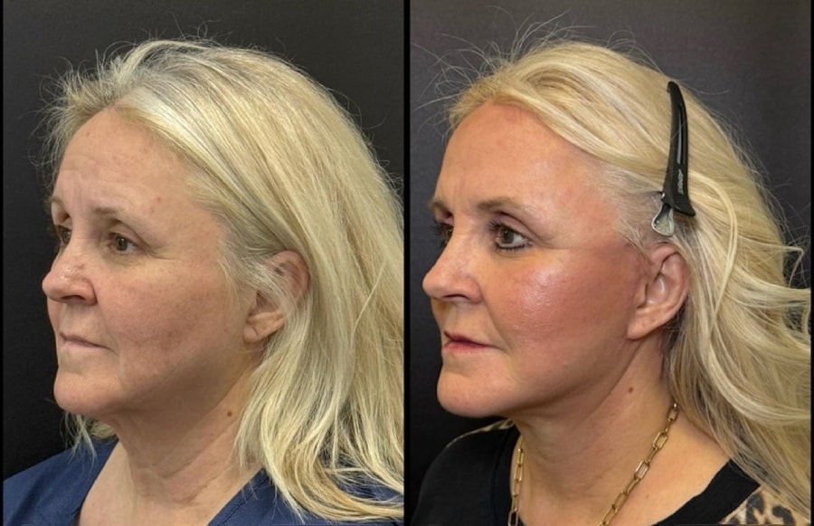 A result from Skin and Face Phoenix