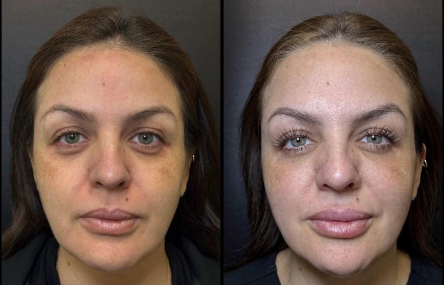 A result from Skin and Face Phoenix