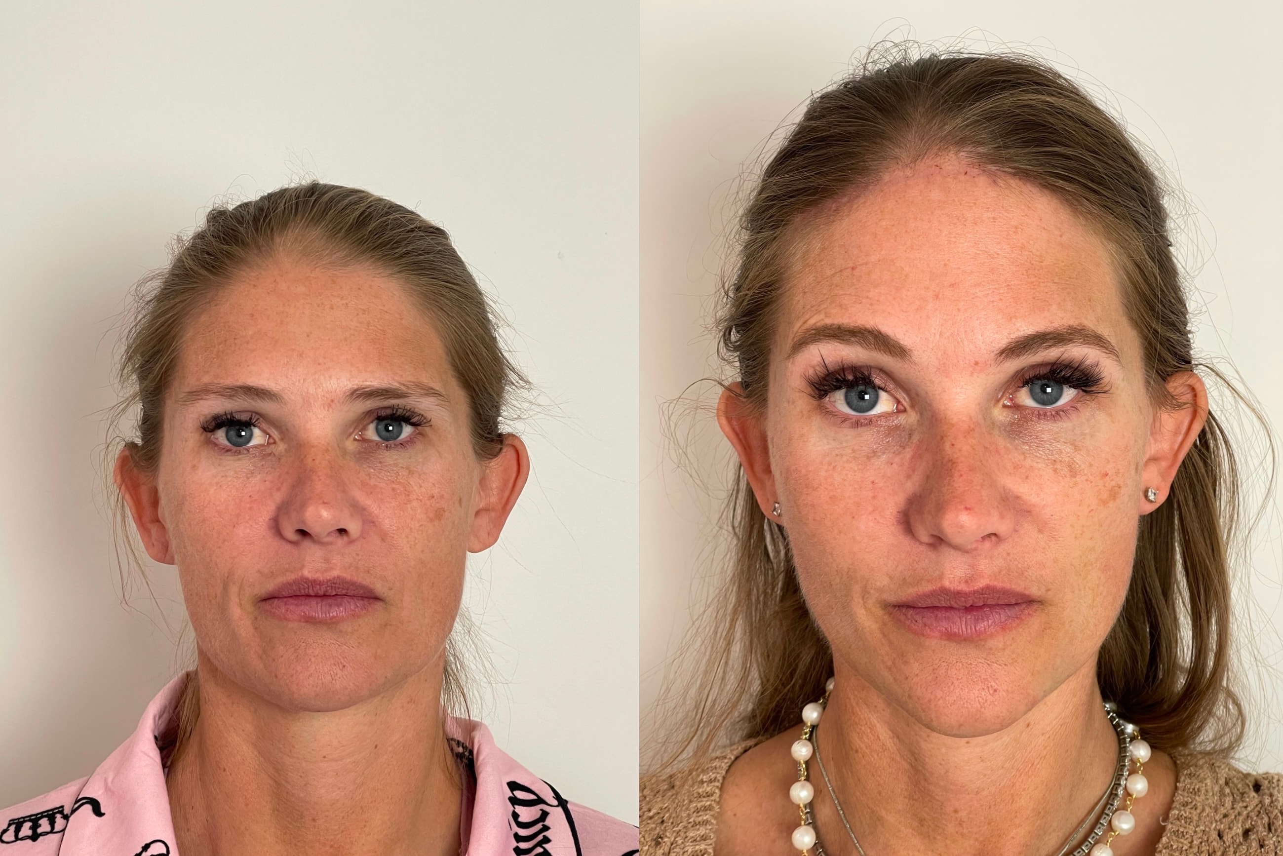 A result from Skin and Face Phoenix