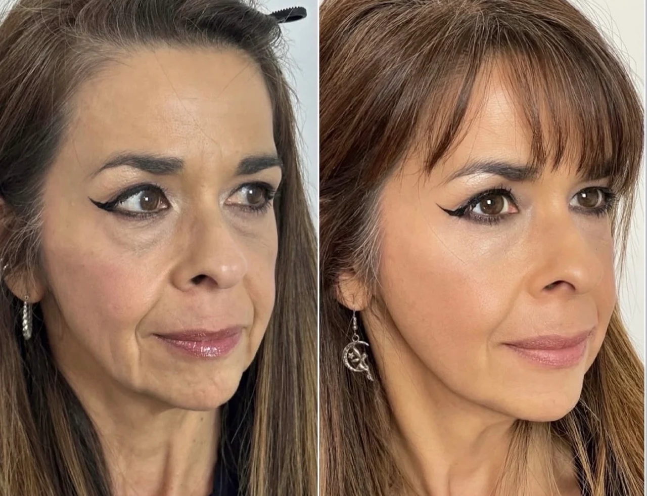 A result from Skin and Face Phoenix