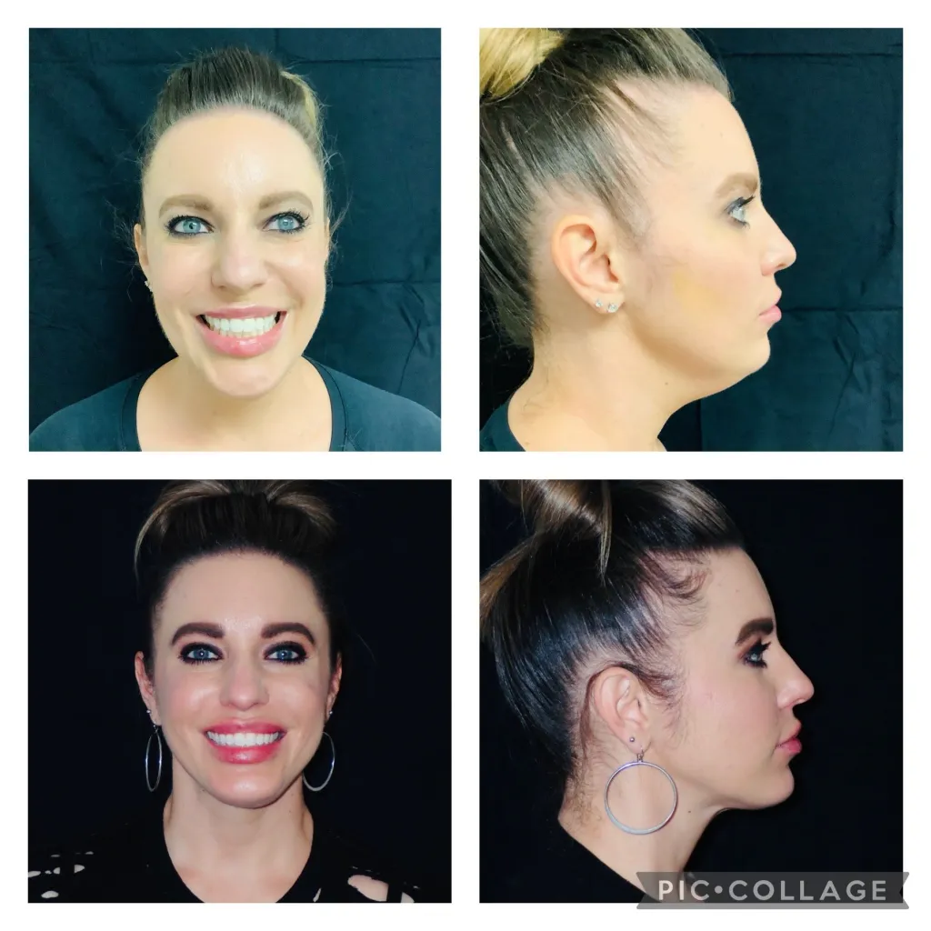 A result from Skin and Face Phoenix