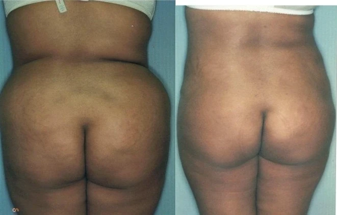 A result from Aesthetic Arts Institute of Plastic Surgery