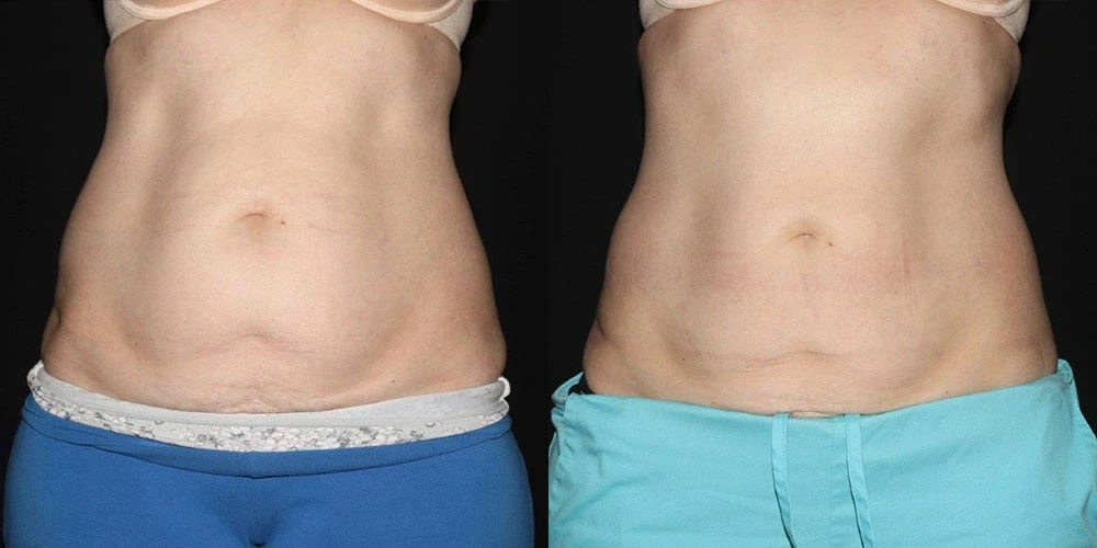 A result from Aesthetic Arts Institute of Plastic Surgery