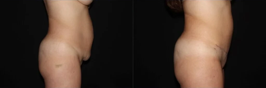 A result from Aesthetic Arts Institute of Plastic Surgery