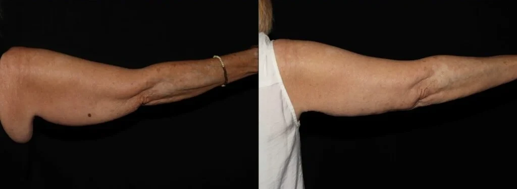 A result from Aesthetic Arts Institute of Plastic Surgery