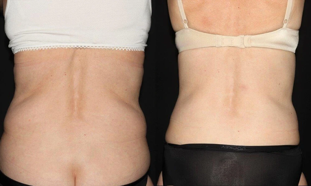 A result from Aesthetic Arts Institute of Plastic Surgery