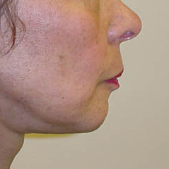 A result from Edmund Kwan, MD