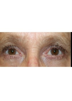 A result from Tanasbourne Plastic Surgery: Cober Sheldon R MD