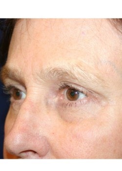 A result from Tanasbourne Plastic Surgery: Cober Sheldon R MD