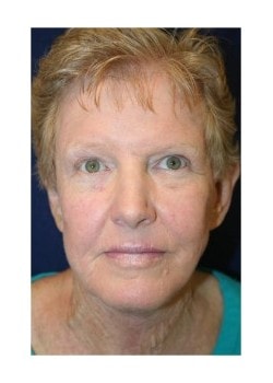 A result from Tanasbourne Plastic Surgery: Cober Sheldon R MD