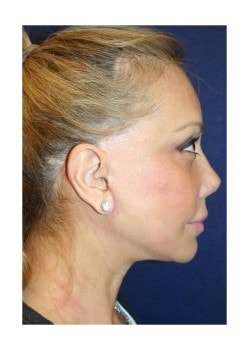 A result from Tanasbourne Plastic Surgery: Cober Sheldon R MD