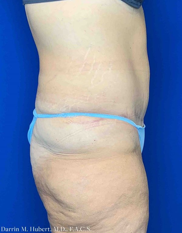 A result from Dr. Darrin M. Hubert, MD