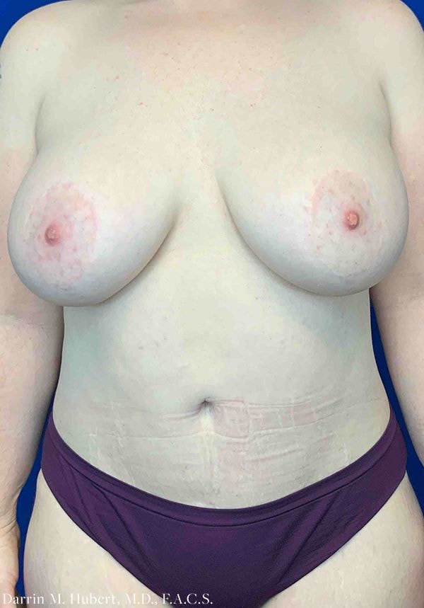 A result from Dr. Darrin M. Hubert, MD