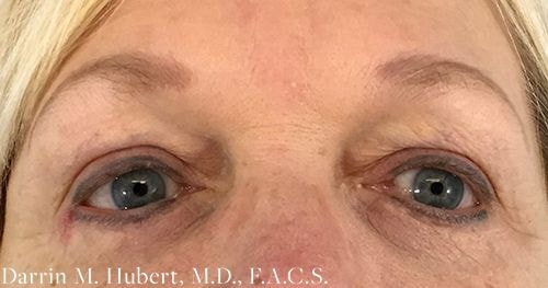 A result from Dr. Darrin M. Hubert, MD