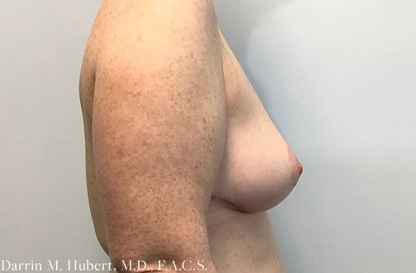 A result from Dr. Darrin M. Hubert, MD