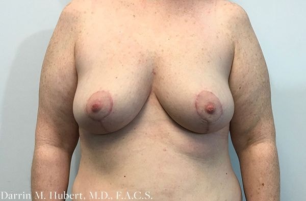 A result from Dr. Darrin M. Hubert, MD