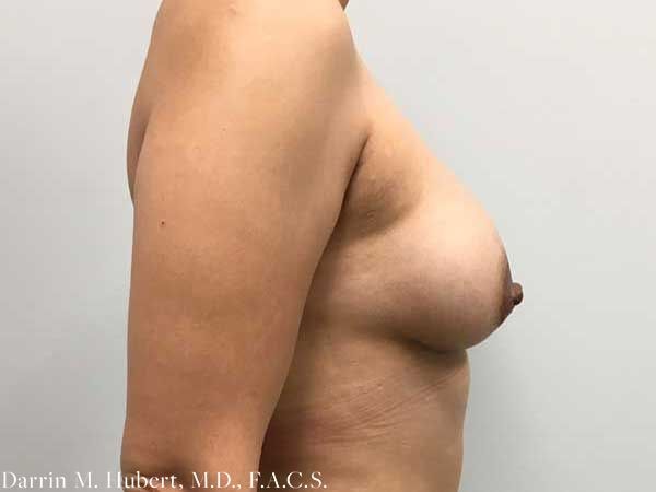 A result from Dr. Darrin M. Hubert, MD