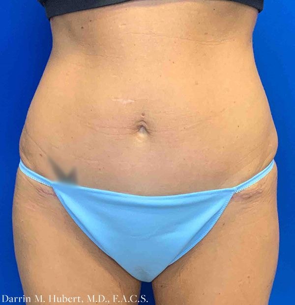 A result from Dr. Darrin M. Hubert, MD
