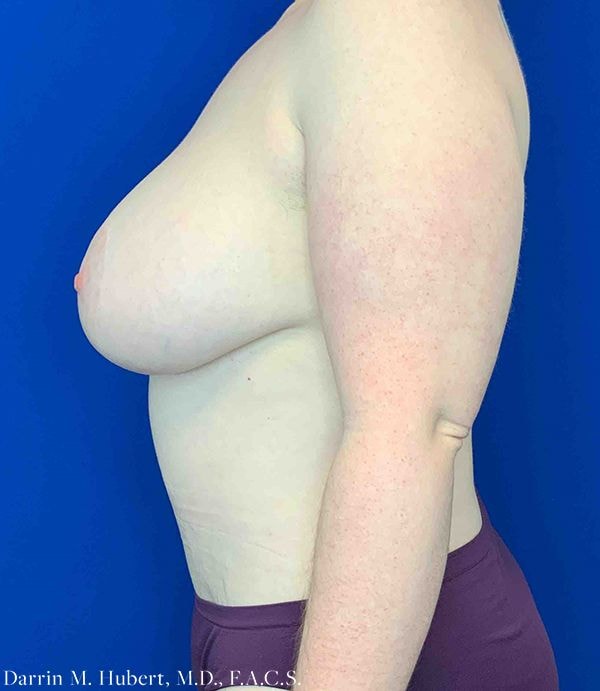 A result from Dr. Darrin M. Hubert, MD