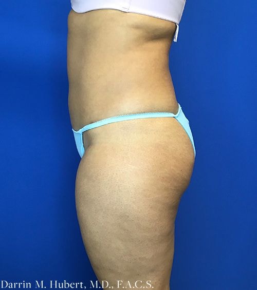 A result from Dr. Darrin M. Hubert, MD