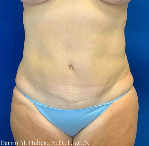 A result from Dr. Darrin M. Hubert, MD